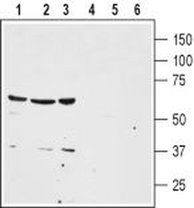 Neurotensin Receptor 1 (extracellular) Antibody in Western Blot (WB)