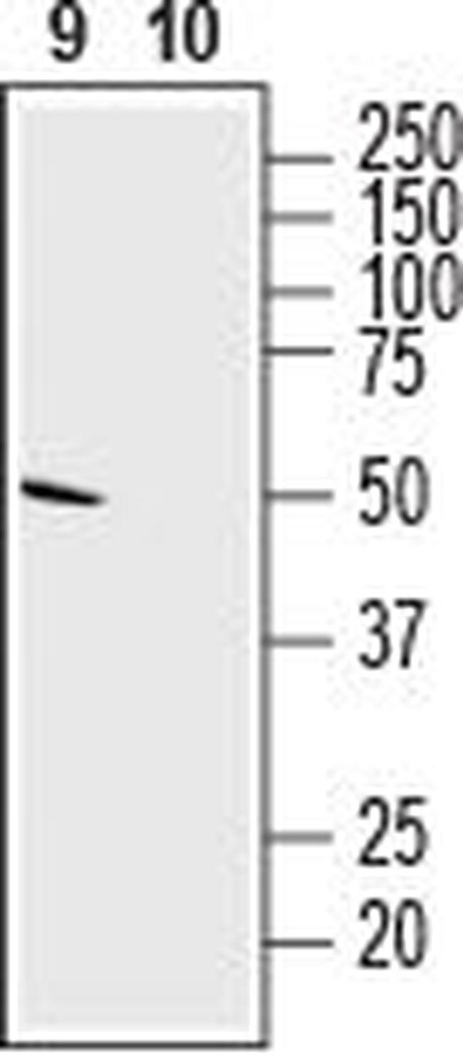 SLC35G1 (extracellular) Antibody in Western Blot (WB)