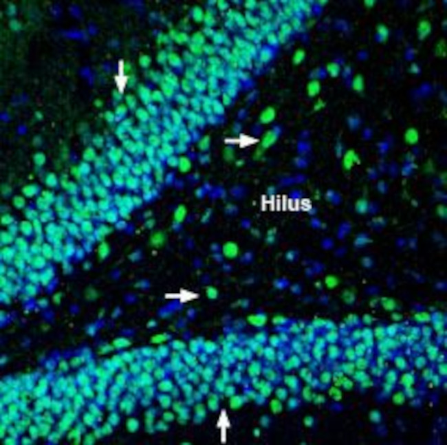 Na+/H+ Exchanger 6 (NHE-6) Antibody in Immunohistochemistry (Frozen) (IHC (F))