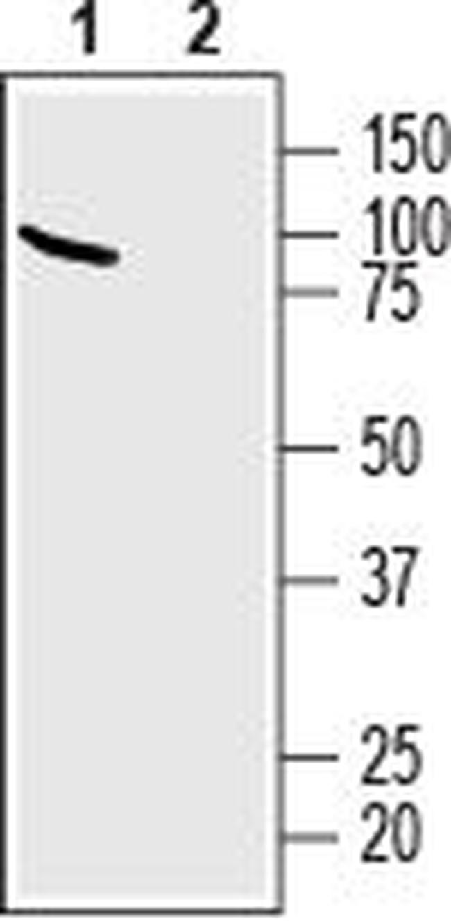 Na+/H+ Exchanger 6 (NHE-6) Antibody in Western Blot (WB)