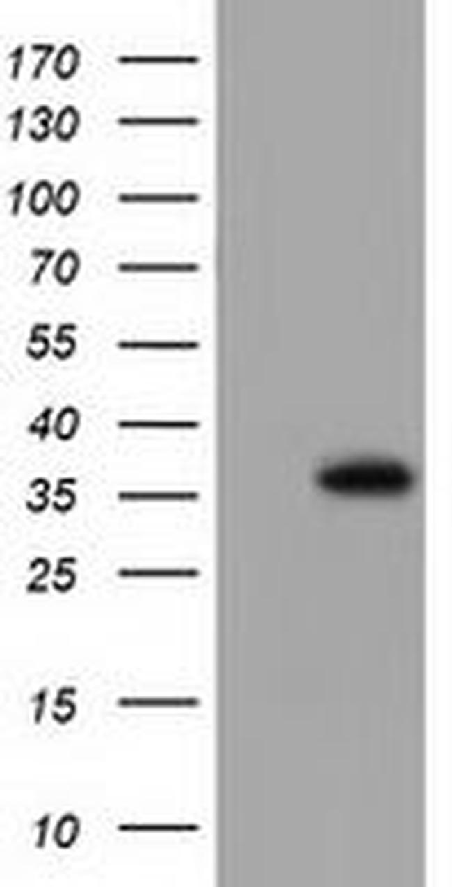 ANXA3 Antibody in Western Blot (WB)