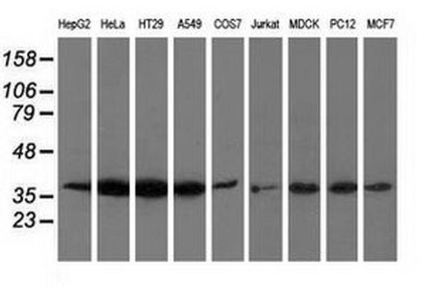 ANXA3 Antibody in Western Blot (WB)