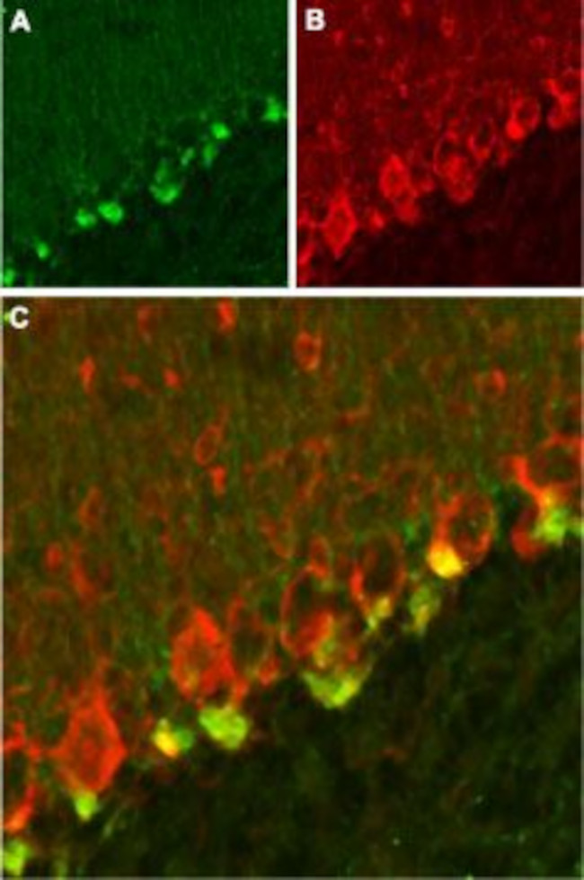 KV beta 2 Antibody in Immunohistochemistry (IHC)