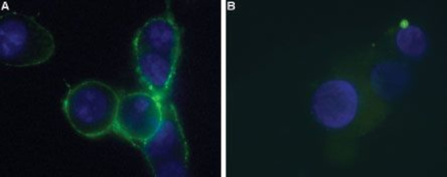 P2X7 Receptor (extracellular) Antibody in Immunocytochemistry (ICC/IF)