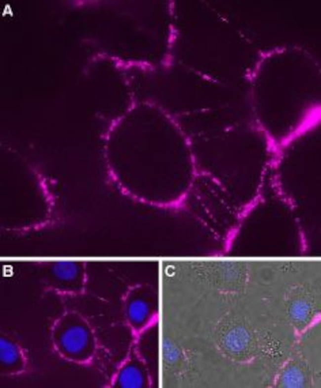 P2X7 Receptor (extracellular) Antibody in Immunocytochemistry (ICC/IF)