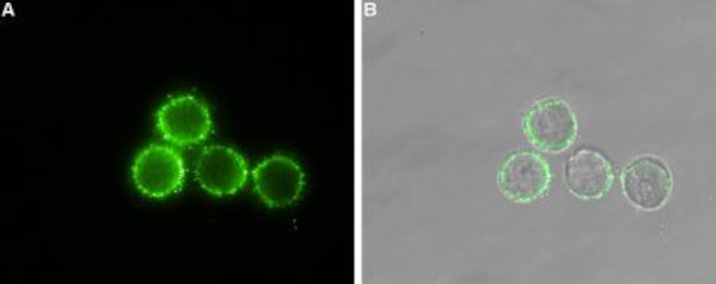 PTH1R (extracellular) Antibody in Immunocytochemistry (ICC/IF)