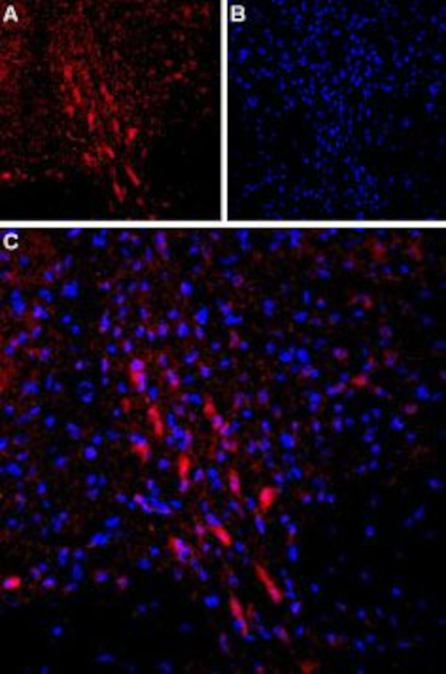 PTH1R (extracellular) Antibody in Immunohistochemistry (Frozen) (IHC (F))