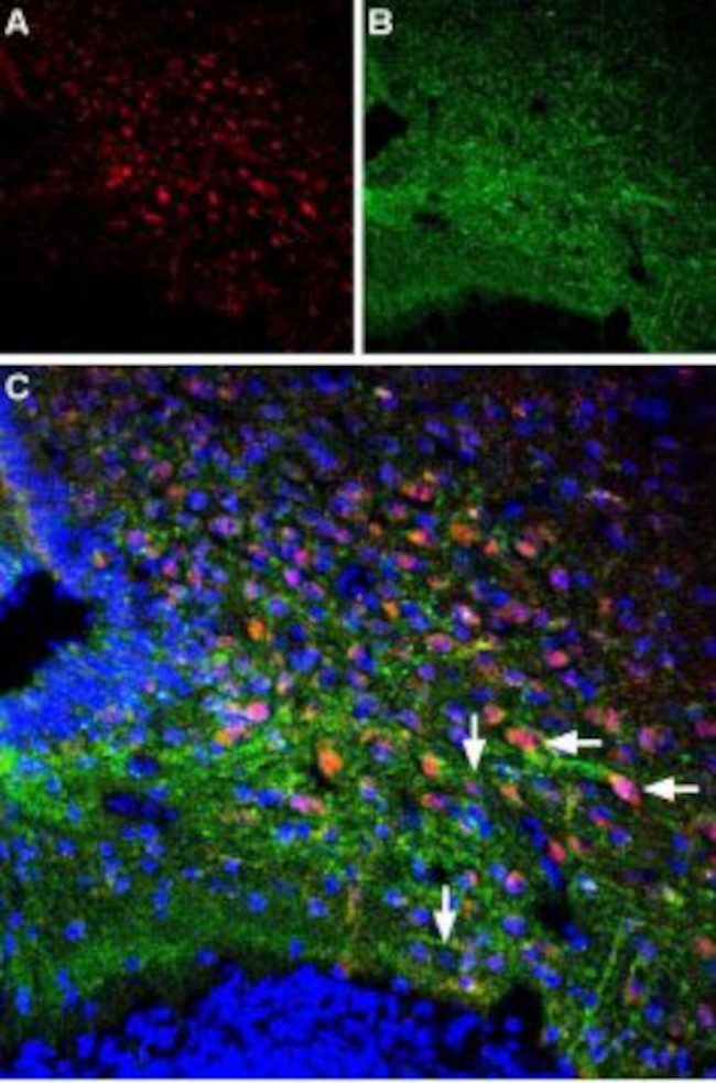 PTH1R (extracellular) Antibody in Immunohistochemistry (Frozen) (IHC (F))