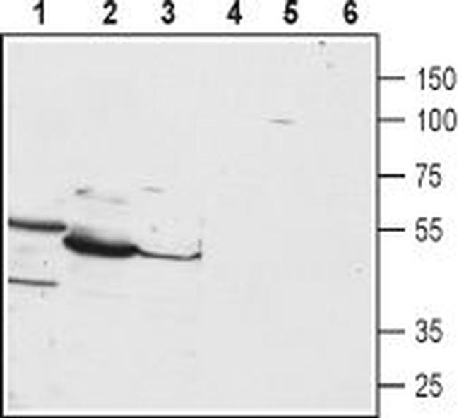 PTH1R (extracellular) Antibody in Western Blot (WB)