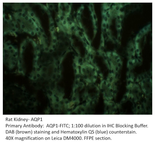 Aquaporin 1 Antibody in Immunohistochemistry (IHC)