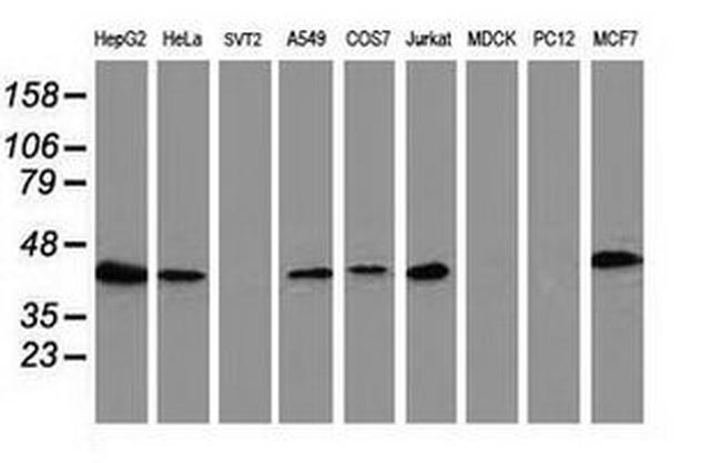 ARFGAP1 Antibody in Western Blot (WB)