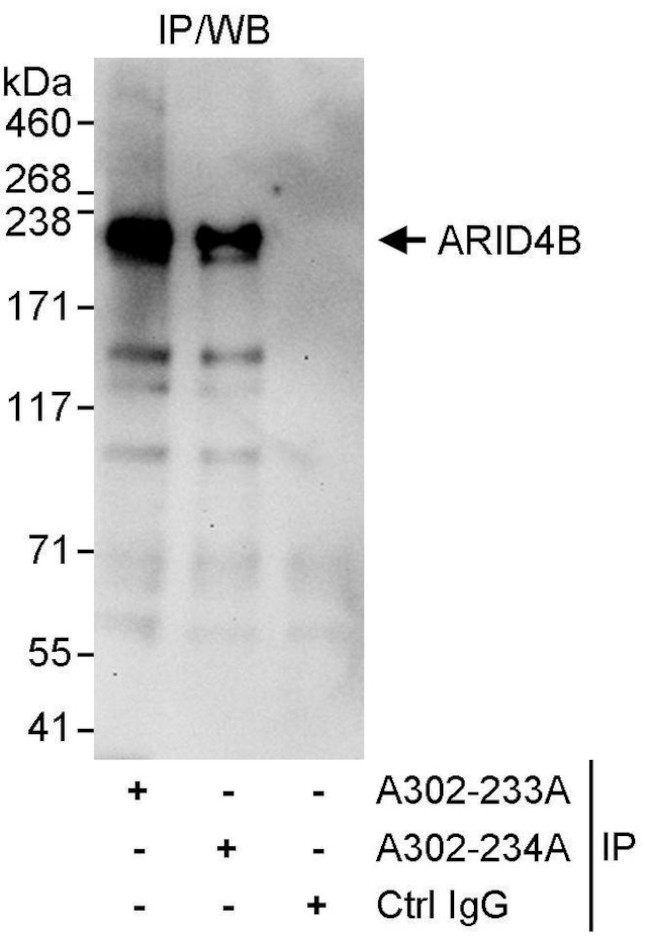 ARID4B Antibody in Immunoprecipitation (IP)