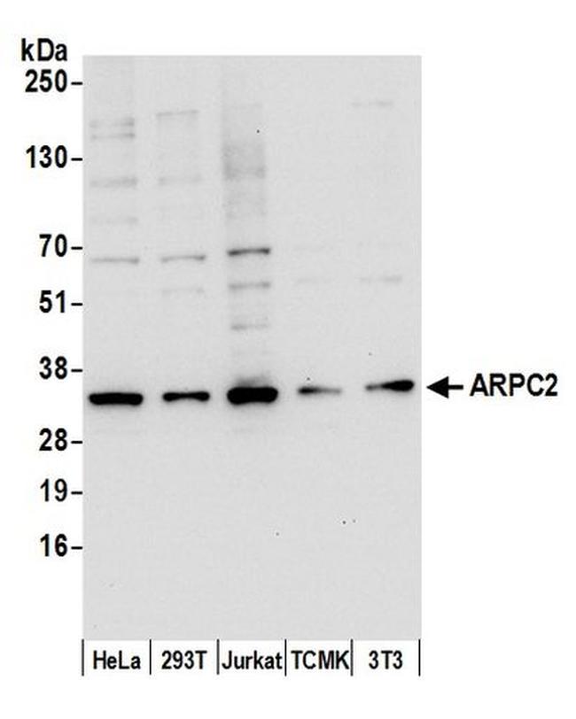 ARPC2 Antibody in Western Blot (WB)