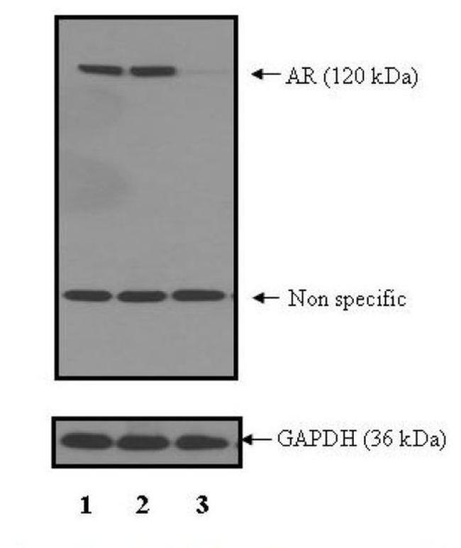 Androgen Receptor Antibody in Western Blot (WB)