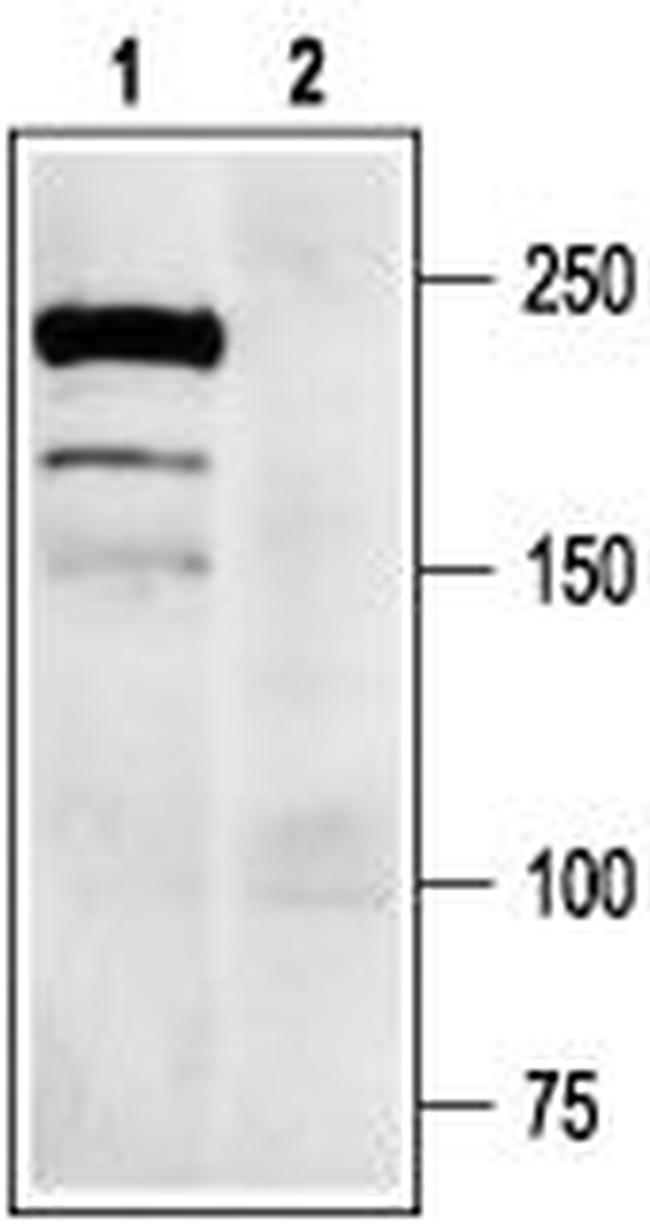 NaV1.7 (SCN9A) Antibody in Western Blot (WB)