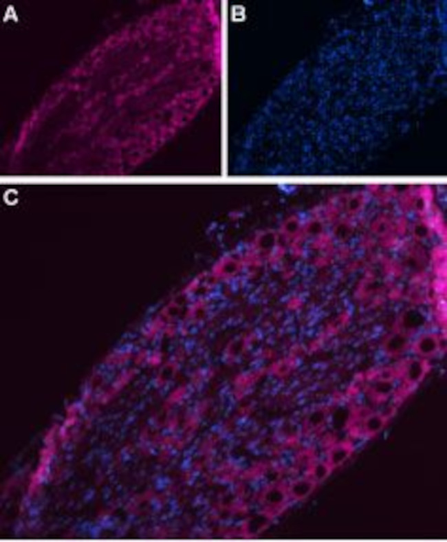 NaV1.7 (SCN9A) Antibody in Immunohistochemistry (IHC)