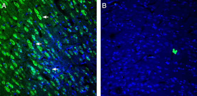 5HT2A Receptor (HTR2A) (extracellular) Antibody in Immunohistochemistry (Frozen) (IHC (F))