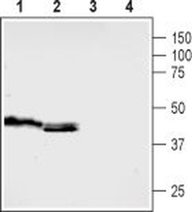 5HT5B Receptor (HTR5B) (extracellular) Antibody in Western Blot (WB)