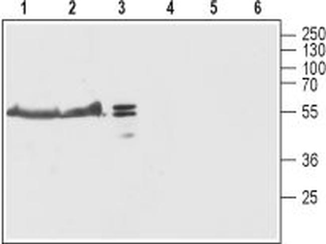 TRIC-B (TMEM38B) Antibody in Western Blot (WB)