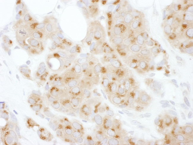 ATF6 Antibody in Immunohistochemistry (IHC)