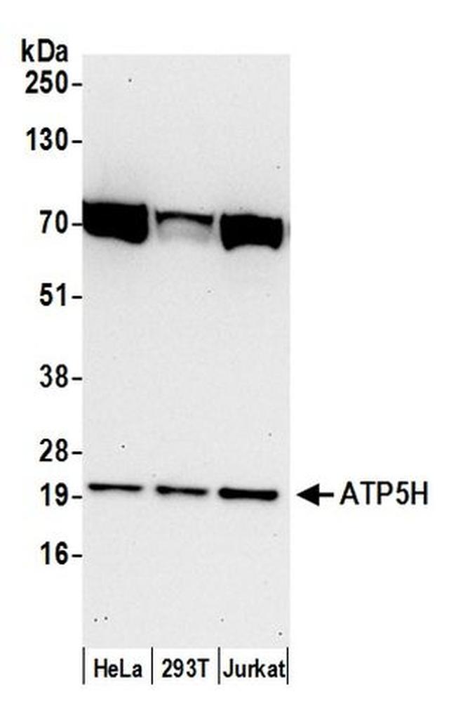 ATP5H Antibody in Western Blot (WB)