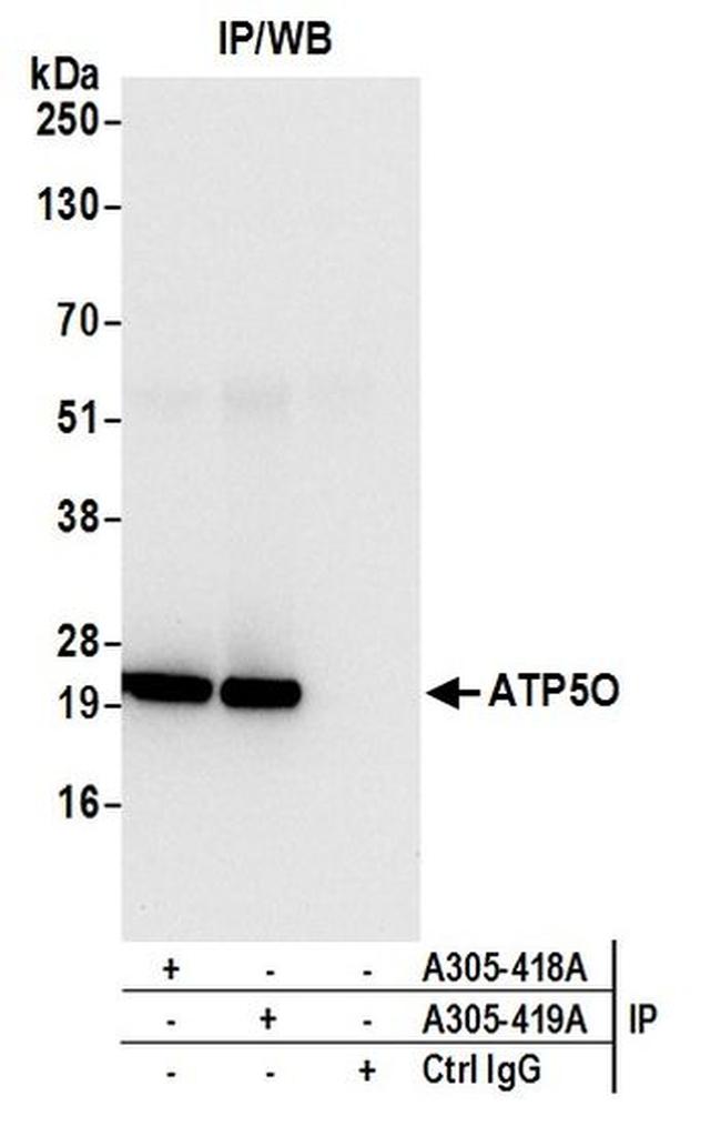 ATP5O Antibody in Western Blot (WB)