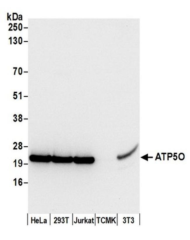 ATP5O Antibody in Western Blot (WB)