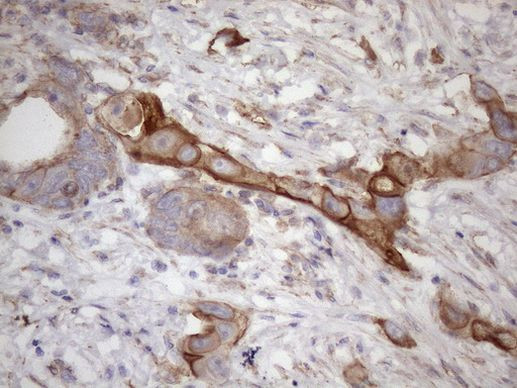 ATP6V1C2 Antibody in Immunohistochemistry (Paraffin) (IHC (P))