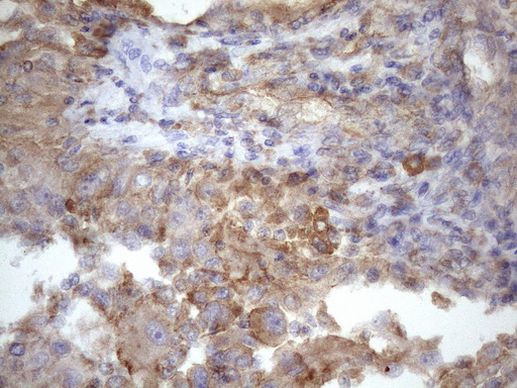 ATP6V1C2 Antibody in Immunohistochemistry (Paraffin) (IHC (P))