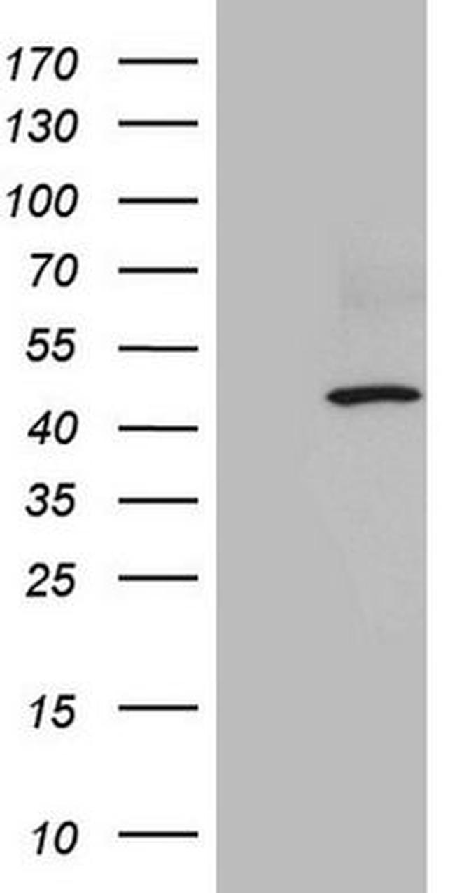 ATP6V1C2 Antibody in Western Blot (WB)