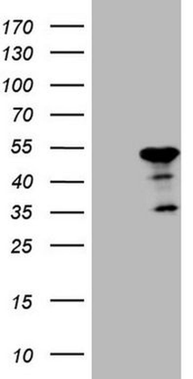 ATP6V1C2 Antibody in Western Blot (WB)