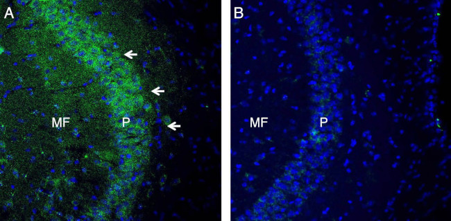 TSH Receptor (TSHR) (extracellular) Antibody in Immunohistochemistry (Frozen) (IHC (F))