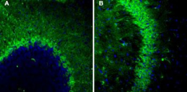 TSH Receptor (TSHR) (extracellular) Antibody in Immunohistochemistry (IHC)