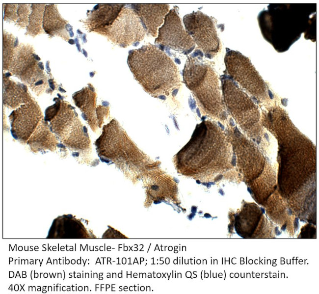 Fbx32 Antibody in Immunohistochemistry (IHC)