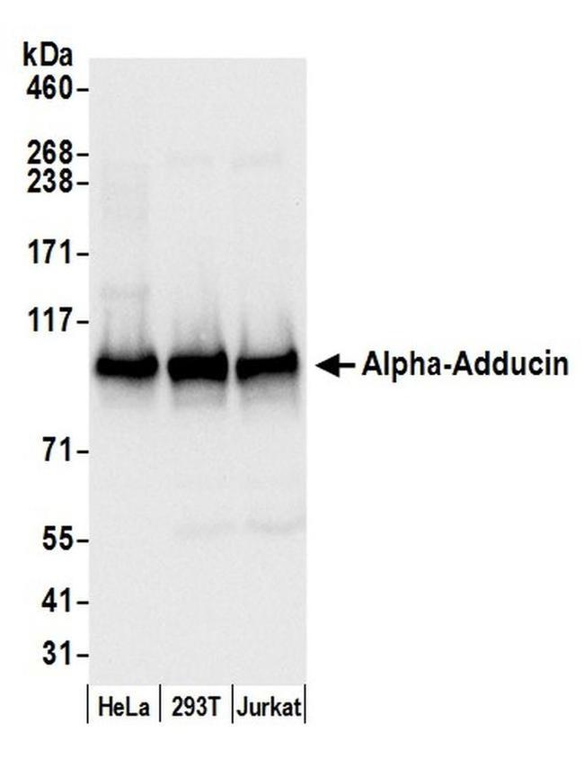 Alpha-Adducin Antibody in Western Blot (WB)