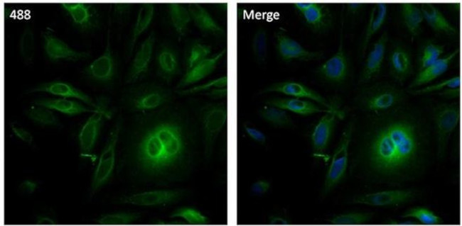 alpha Tubulin Antibody in Immunocytochemistry (ICC/IF)