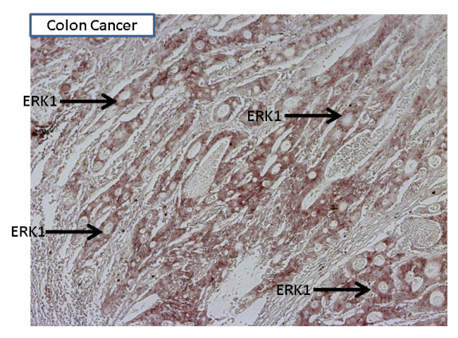 ERK1 Antibody in Immunohistochemistry (Paraffin) (IHC (P))