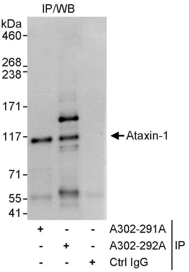 Ataxin-1 Antibody in Immunoprecipitation (IP)
