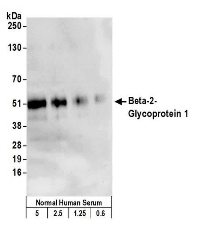 Beta-2-Glycoprotein 1 Antibody in Western Blot (WB)