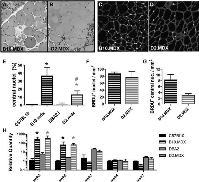 BrdU Antibody in Immunohistochemistry (IHC)