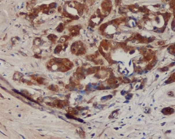 B7-H4 Antibody in Immunohistochemistry (Paraffin) (IHC (P))