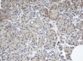 BCL10 Antibody in Immunohistochemistry (Paraffin) (IHC (P))