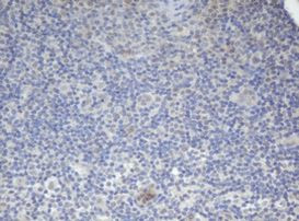 BCL10 Antibody in Immunohistochemistry (Paraffin) (IHC (P))