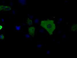 BDH2 Antibody in Immunocytochemistry (ICC/IF)