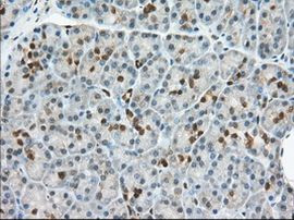 BDH2 Antibody in Immunohistochemistry (Paraffin) (IHC (P))