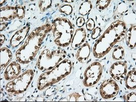 BDH2 Antibody in Immunohistochemistry (Paraffin) (IHC (P))