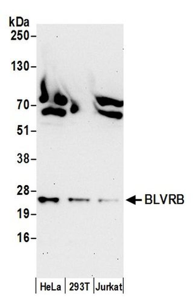 BLVRB/Biliverdin Reductase B Polyclonal Antibody (A305-569A)