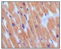 BNP Antibody in Immunohistochemistry (Paraffin) (IHC (P))