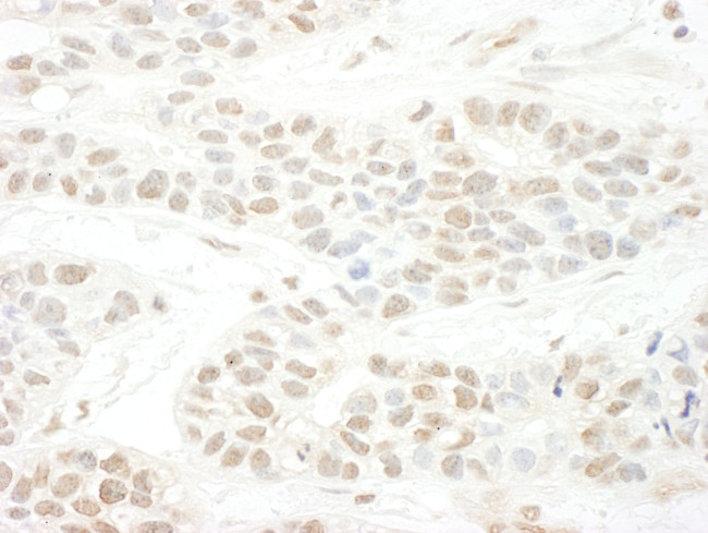 BTBD12 Antibody in Immunohistochemistry (IHC)