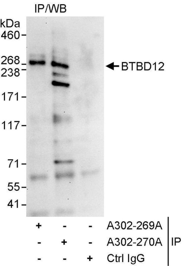 BTBD12 Antibody in Immunoprecipitation (IP)